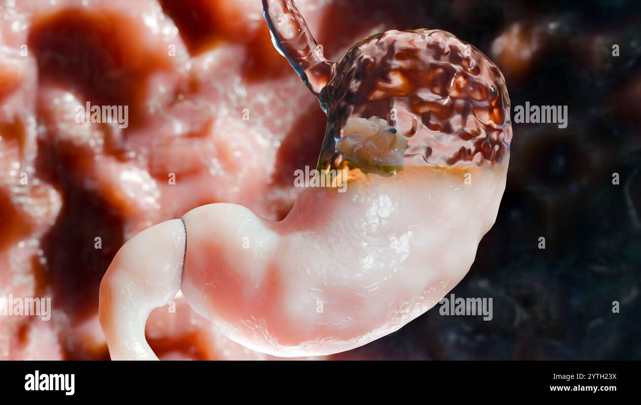 Stomaco umano anatomia digestione, esofago addome gastrico con digestivo acido, contrazione della parete dello stomaco, organo interno, intestino gastrico, processo di brea Foto Stock