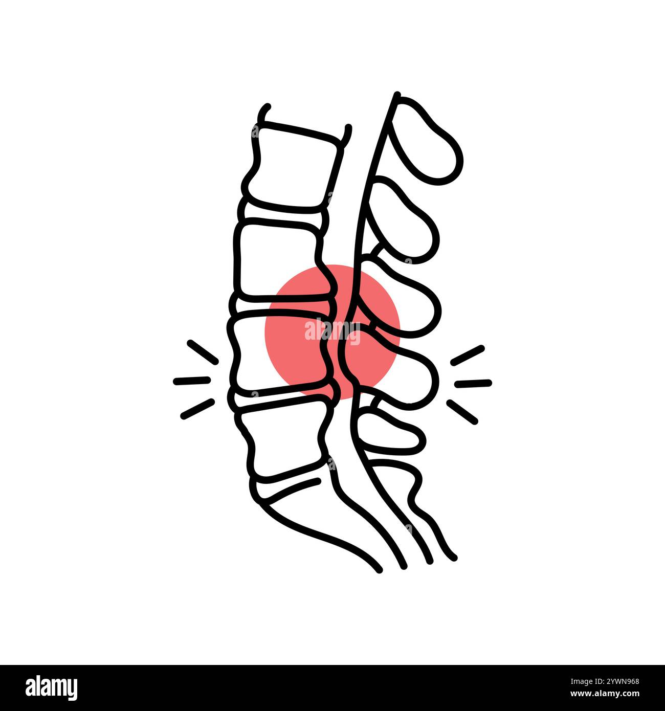 Icona della linea di colore della stenosi lombare. Malattie della colonna vertebrale. Vertebrologia. Elemento isolato vettoriale. Traccia modificabile. Illustrazione Vettoriale