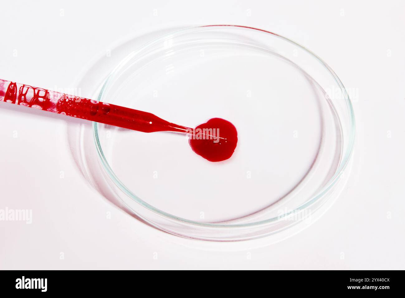 Pipettare con sangue e piastra Petri da laboratorio con una goccia di sangue Foto Stock