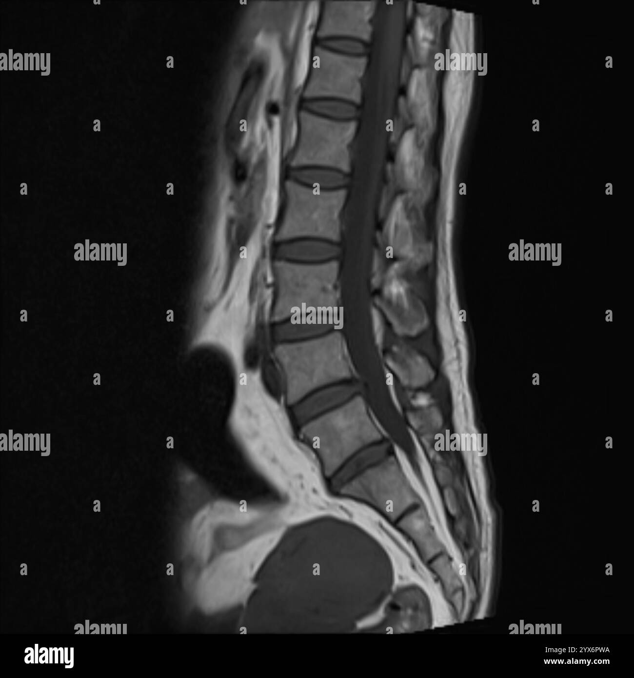 Risonanza magnetica sagittale (MRI) scansione di una colonna vertebrale sana. Foto Stock