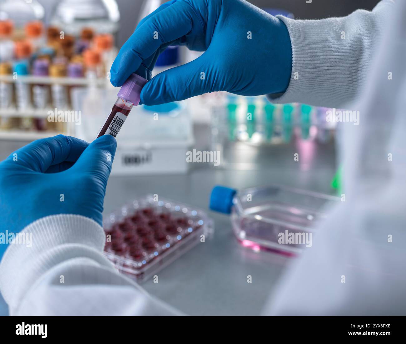 Scienziato che prepara un campione di sangue per l'analisi analitica. Foto Stock