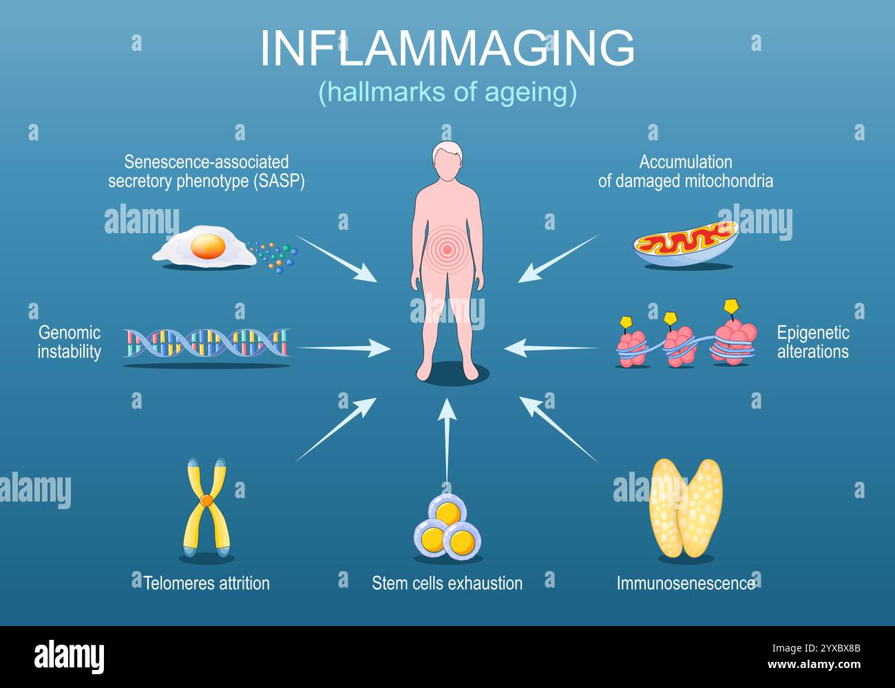 Inflammaging. Segni distintivi dell'invecchiamento. Infiammazione cronica che si sviluppa con l'età avanzata. Terapia anti-invecchiamento. Medicina anti-invecchiamento. Illustrazione vettoriale Illustrazione Vettoriale