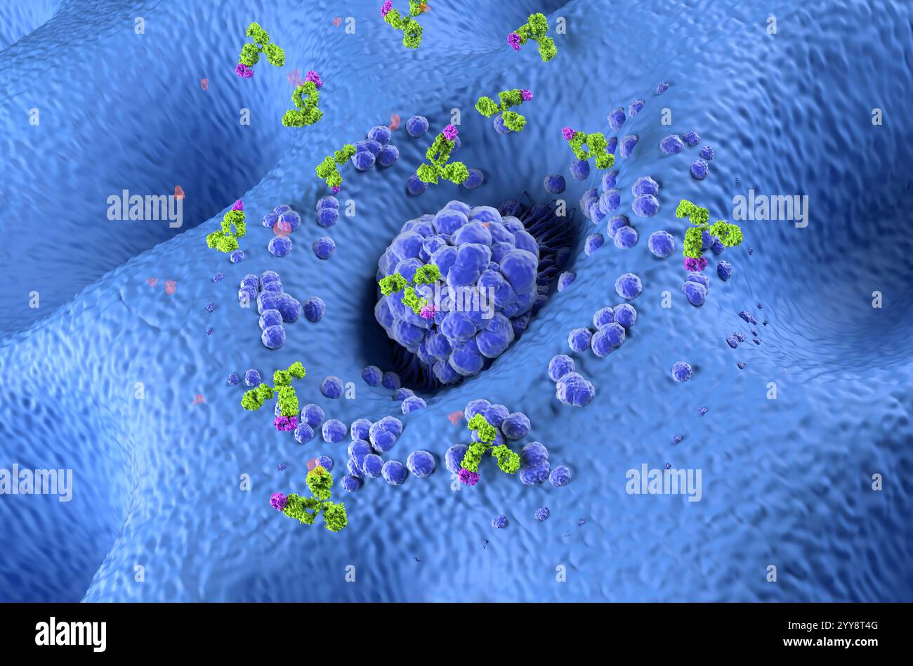 Terapia con anticorpi monoclonali nel cancro dello stomaco (gastrico) - Vista isometrica illustrazione 3d. Foto Stock