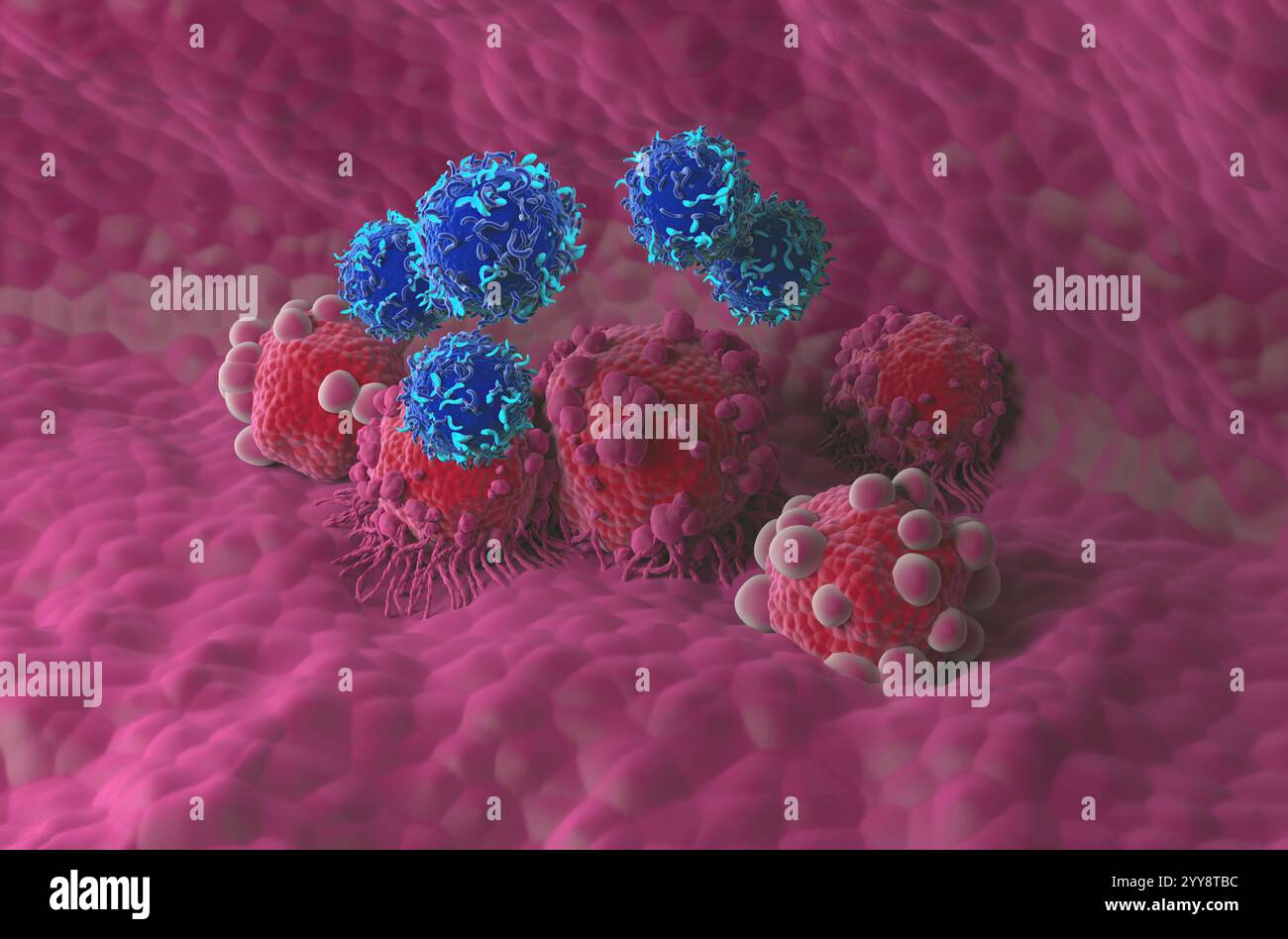 Terapia con cellule T di CAR nel cancro del pancreas - Vista isometrica illustrazione 3d. Foto Stock