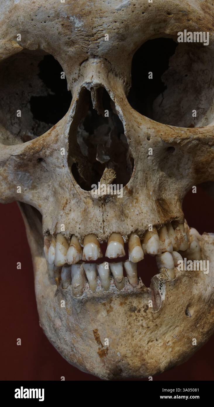 Un cranio medievale in mostra nel museo di Winchester Foto Stock