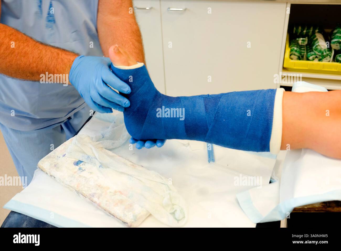 Un medico mette la gamba rotta di un giovane calciatore in gesso dopo un infortunio sportivo Foto Stock