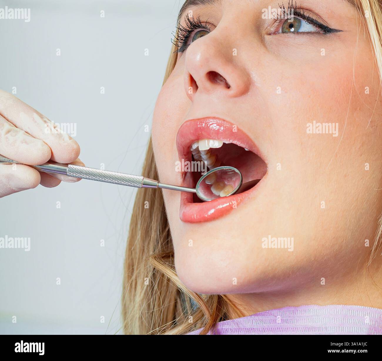 Dentista che esamina i denti del paziente con uno specchio dentale in una clinica moderna. I denti devono essere puliti a causa del tartaro e dello sbiancamento dovuto all'ingiallimento dello smalto dei denti. Foto Stock