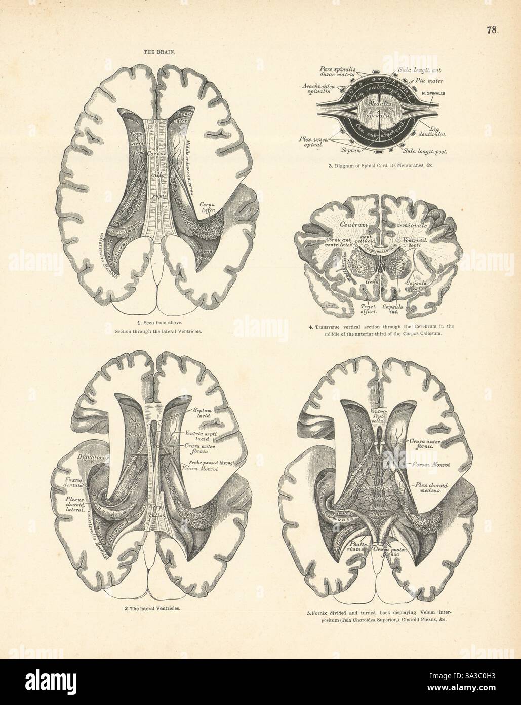 Anatomia. Il Brain 1880 vecchia immagine vintage Foto Stock