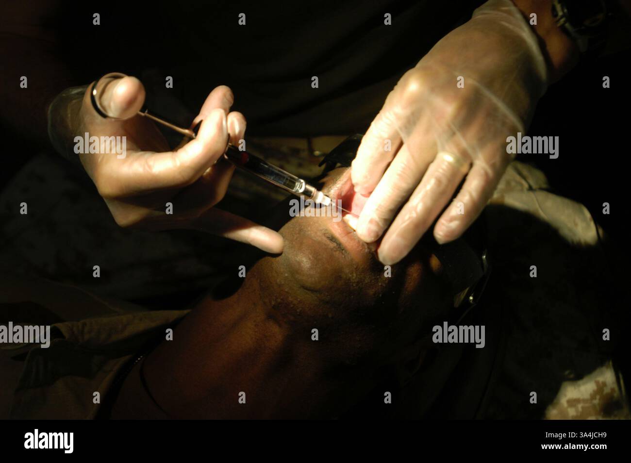 2 agosto 2004; Camp Taqaddum, Iraq; cmdr. ROBERT D. RUPPRECHT, 43 anni, consulente dentale senior per il 1st Force Service Support Group in Iraq, inietta anestetico nelle gengive del Sgt. TIMTHY SMITH durante un controllo a Camp Taqaddum, Iraq, il 2 agosto 2004. Dato che i Marines erano sempre in marcia, molti in servizio in Iraq lo scorso anno non hanno ricevuto alcuna forma di cure dentistiche, e quando le cure sono state rese, raramente è stato documentato. Quattro squadre dentistiche mobili sono state organizzate per il dispiegamento di quest’anno a sostegno dell’operazione Iraqi Freedom come risposta alle limitate cure dentistiche disponibili lo scorso anno. Rupp Foto Stock