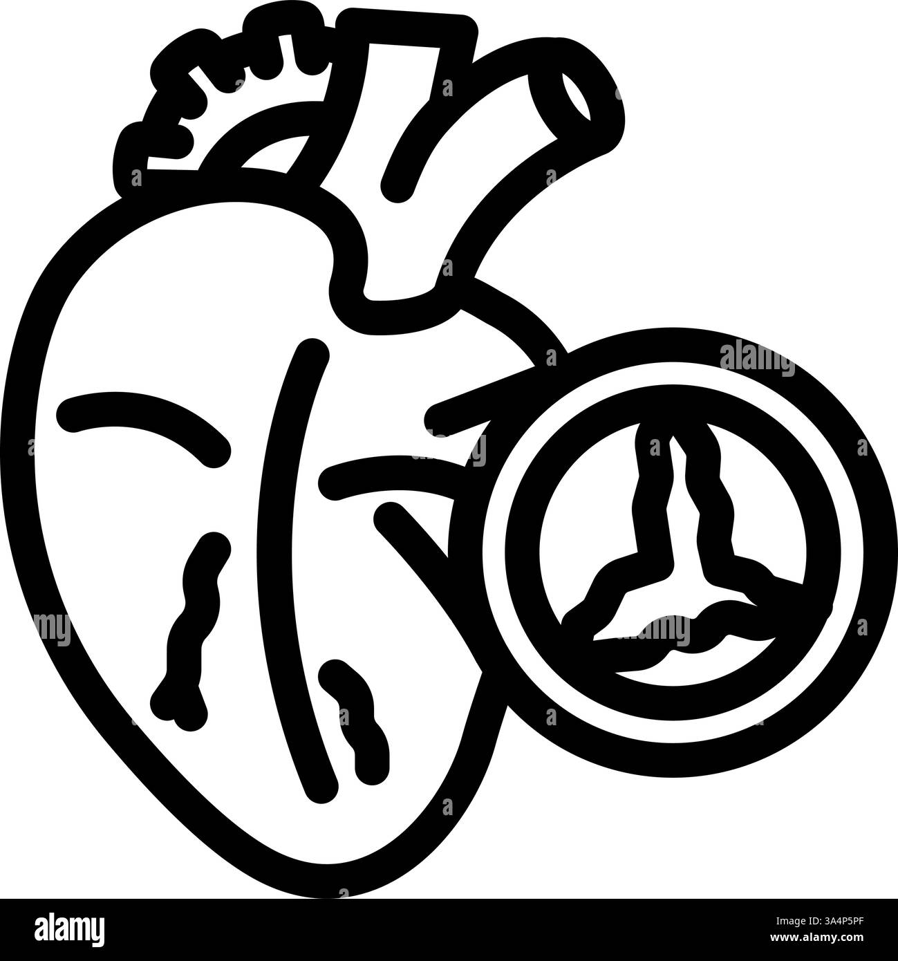 illustrazione vettoriale dell'icona della linea della malattia cardiologica della valvola cardiaca Illustrazione Vettoriale