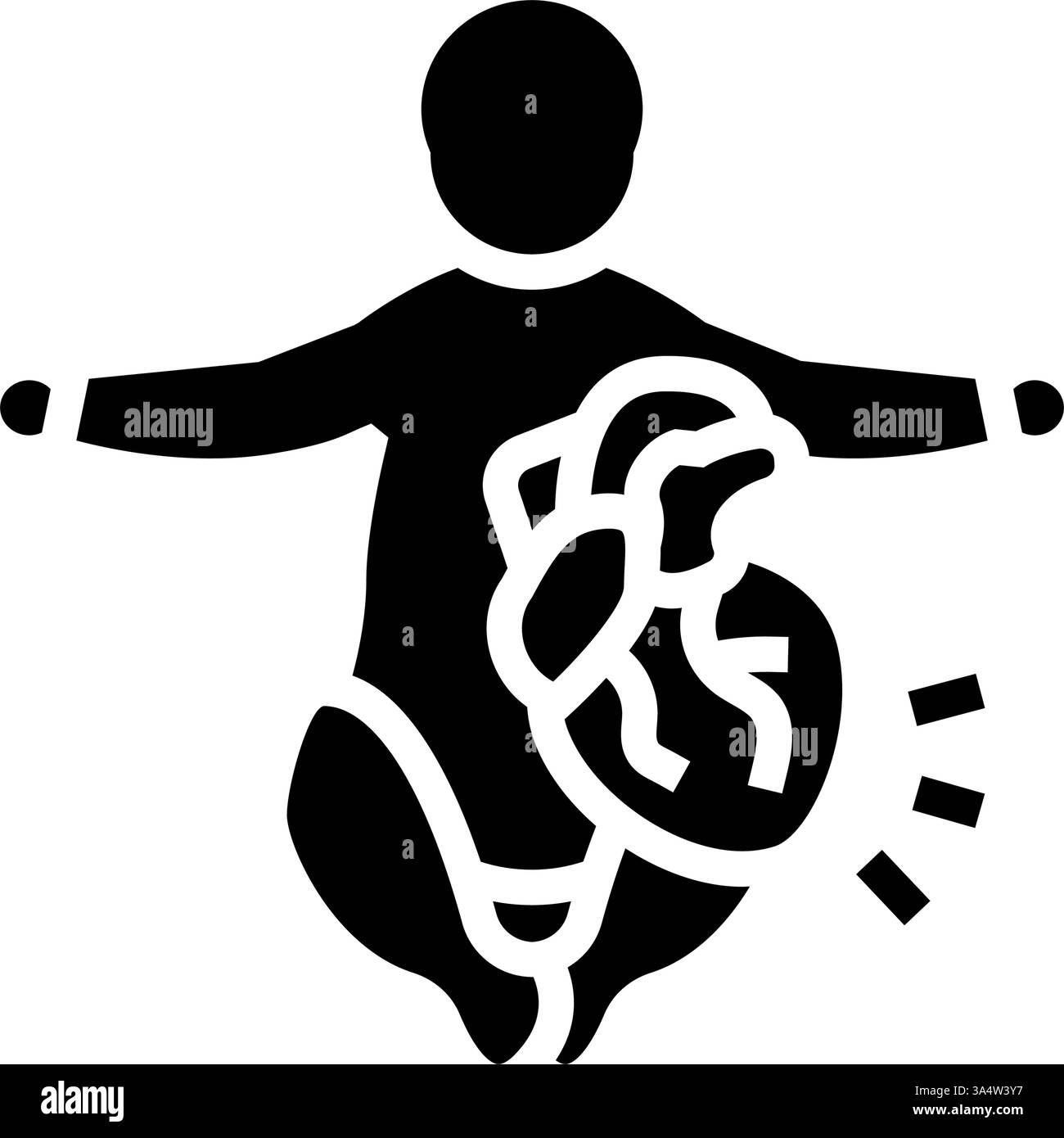 illustrazione vettoriale icona glifo di cardiologia congenita cardiologia Illustrazione Vettoriale