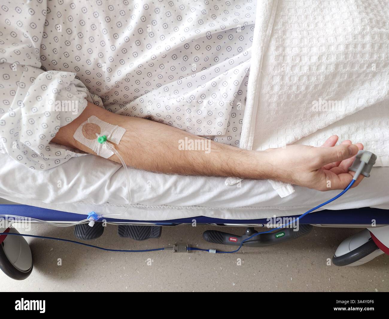 Flebo IV, cannula o branula e pulsossimetro collegato al braccio di un uomo caucasico. Sdraiato in letto d'ospedale, abito paziente medico, primo piano tiro, unrec Foto Stock