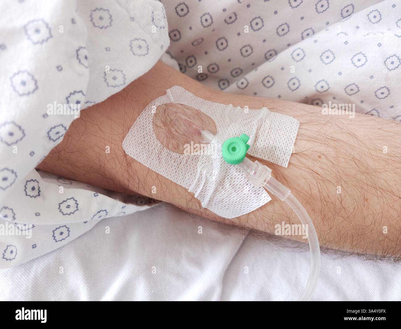 Flebo IV, cannula o branula collegati al braccio di un uomo caucasico. Sdraiato nel letto d'ospedale, abito paziente medico, primo piano tiro, irriconoscibile, pulito Foto Stock