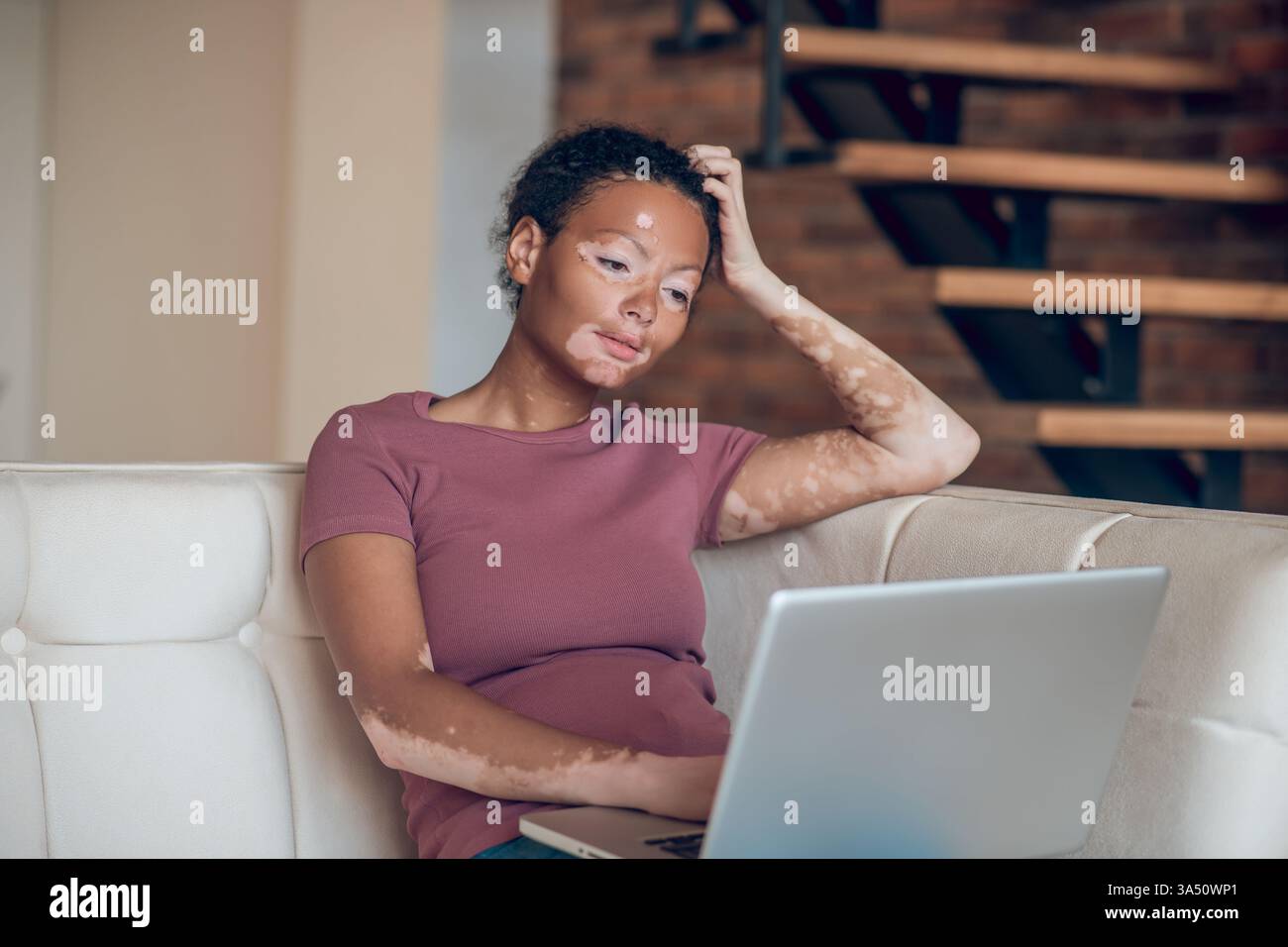 Donna mista con vitiligine che si rilassa a casa mentre usa un laptop sul divano. Ideale per la bellezza inclusiva, il lavoro a distanza e le immagini dello stile di vita quotidiano. Foto Stock