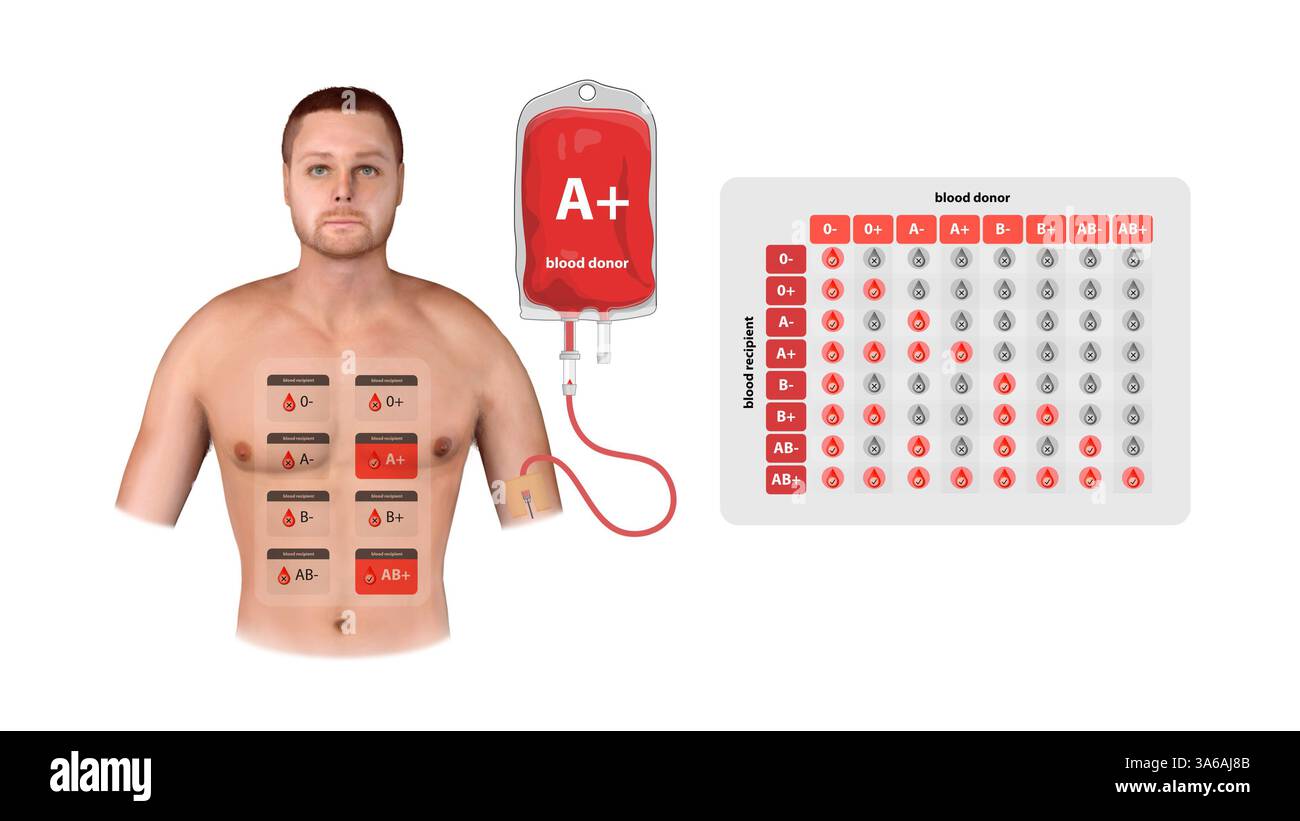 Un'illustrazione medica di un donatore positivo, che mostra il processo di trasfusione, la compatibilità del ricevente e un grafico informativo del tipo di sangue, 3d. Foto Stock