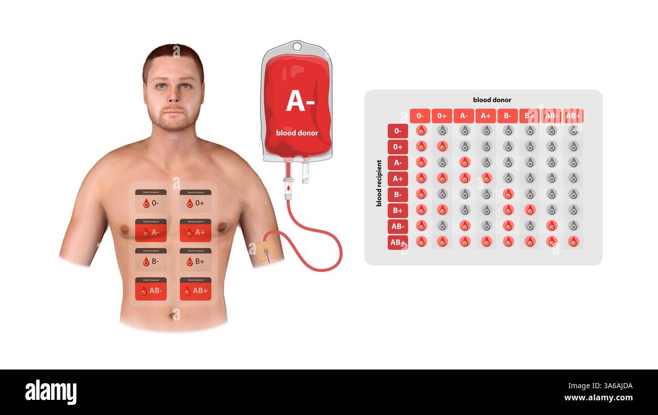 Un'illustrazione medica di un donatore negativo, che mostra i dettagli delle trasfusioni, la compatibilità del ricevente e un grafico dettagliato di corrispondenza del tipo di sangue, 3d. Foto Stock