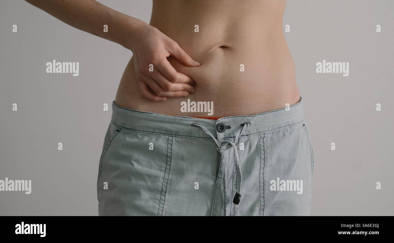 Donna che pizzica il grasso della pancia, perdita di peso, corpo sano, peso in eccesso, percorso di fitness Foto Stock