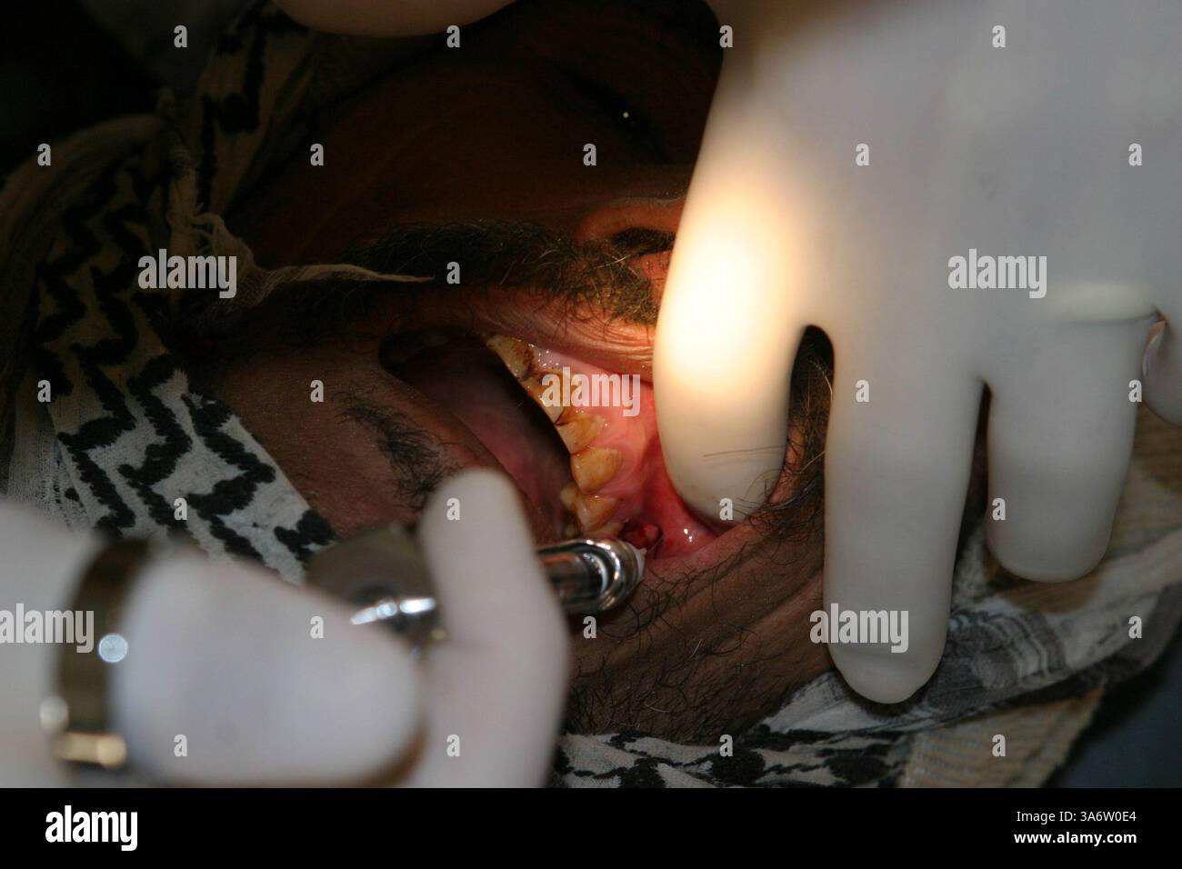27 novembre 2004; An Najaf, Iraq; Navy LT BRIAN OLSEN, dentista, Health Services Detachment, Marine Expeditionary Unit Service Support Group 11, 11th MEU (Special Operations Capable), inietta un anestetico dopo aver estratto un dente durante un'operazione di assistenza umanitaria nel villaggio di Musa al Umran come Sardun qui, 27 novembre. Foto Stock