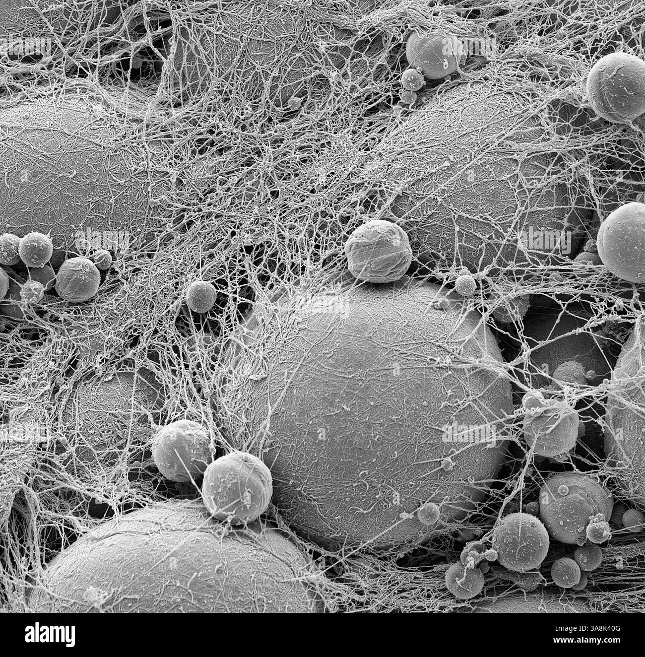 Cellule adipose. Micrografia elettronica a scansione in bianco e nero (SEM) di cellule unite di conservazione del grasso (adipociti). Le cellule adipose sono uno dei più grandi tipi di cellule del corpo umano, ciascuna delle quali ha un diametro compreso tra 100 e 120 micron. Quasi l'intero volume di una singola cellula adiposa è costituito da una singola goccia lipidica (grasso o olio). Le cellule adipose e il loro tessuto connettivo di supporto (che circonda le cellule adipose) costituiscono il tessuto adiposo. Il tessuto adiposo forma uno strato isolante sotto la pelle, immagazzinando l'energia sotto forma di grasso creato dal cibo in eccesso. Ingrandimento se stampato a 10 cm di larghezza: X 350 Foto Stock
