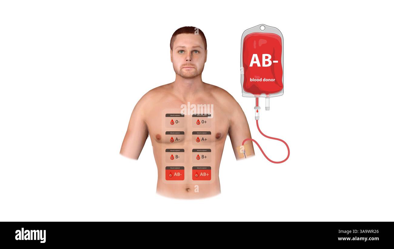 Un'illustrazione medica di un donatore AB negativo, che mostra i dettagli delle trasfusioni, la capacità del ricevente universale e una tabella di compatibilità dei tipi di sangue, 3d. Foto Stock