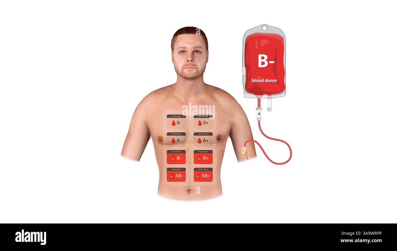 Un'illustrazione medica di un donatore B negativo, che mostra il processo di trasfusione, la compatibilità con il ricevente e una tabella completa dei tipi di sangue Foto Stock