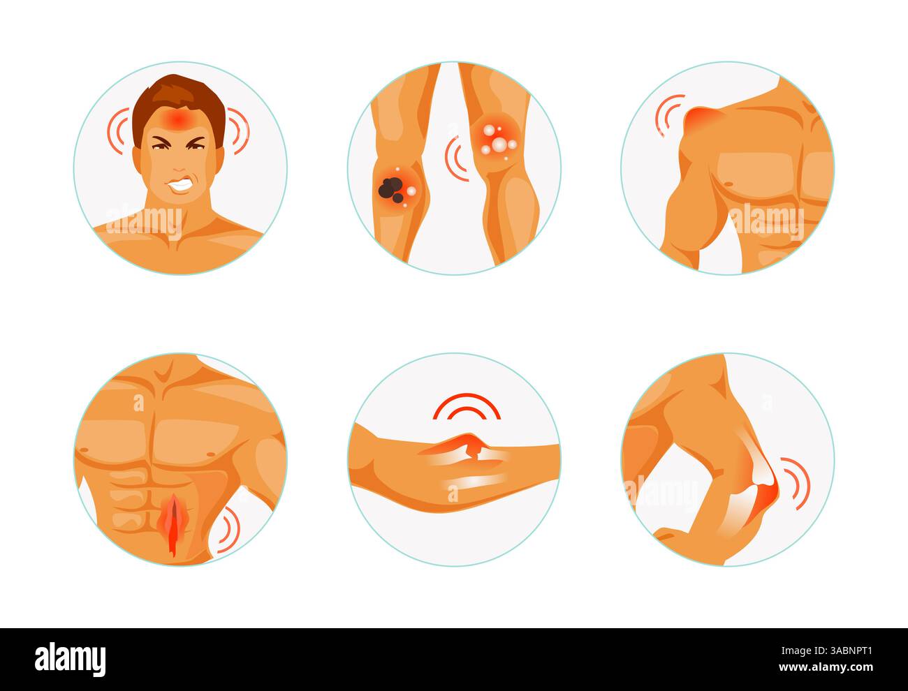 Posizionare le parti del corpo con vari tipi di lesioni. Commozione cerebrale, ustioni, lividi, lesioni, frattura e lussazione. Illustrazione vettoriale Illustrazione Vettoriale