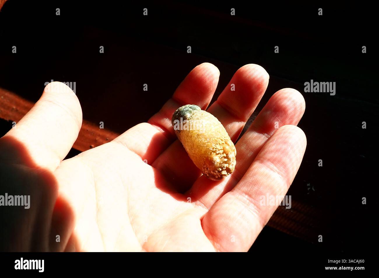 Malattia di calcoli biliari, colelitiasi - la formazione di pietre, pietre nella cistifellea, dotti biliari. Calcoli biliari. Un grande gallstone rimosso da un patie Foto Stock