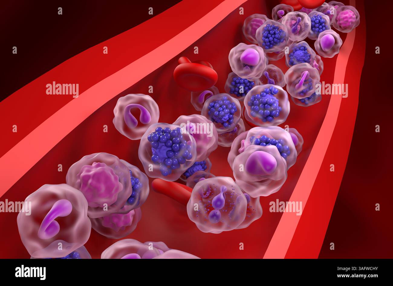 Linfoma diffuso a grandi cellule B (DLBCL) - Vista ravvicinata illustrazione 3d. Foto Stock