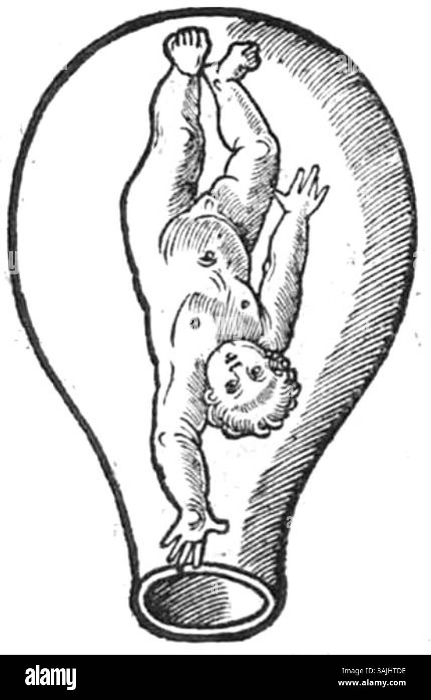 Pagina 33, parte 2, da "Der Swangern frawen vnd hebammen roszgarten" di Eucharius Rößlin, pubblicato nel 1513. Fornisce ulteriori rimedi per le donne incinte e le ostetriche. Foto Stock