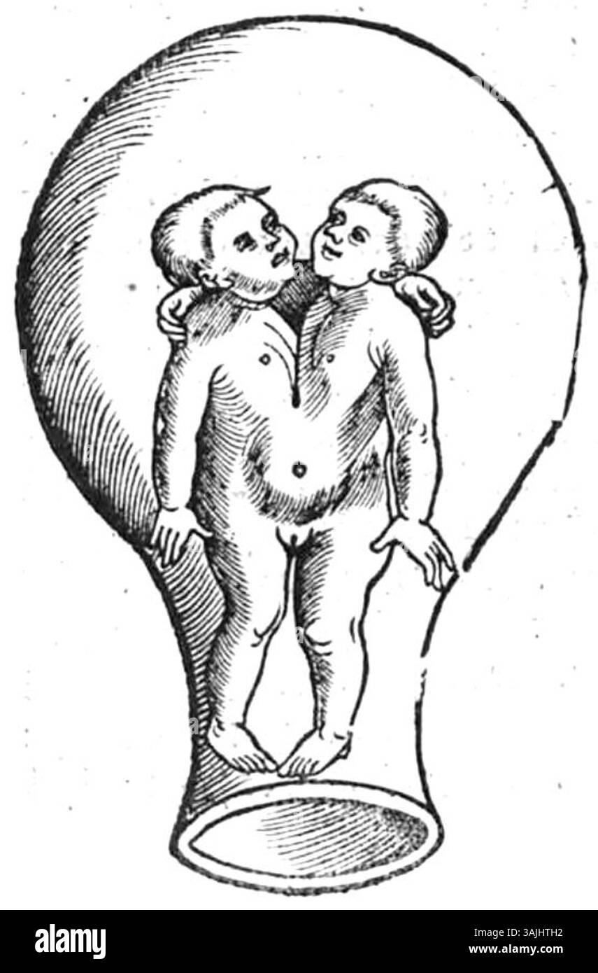 Pagina 19 immagine dal libro "Der Swangern frawen vnd hebammen roszgarten" di Eucharius Rößlin, datato 1513. La pagina include rimedi a base di erbe e pratiche mediche per donne incinte e ostetriche. Foto Stock