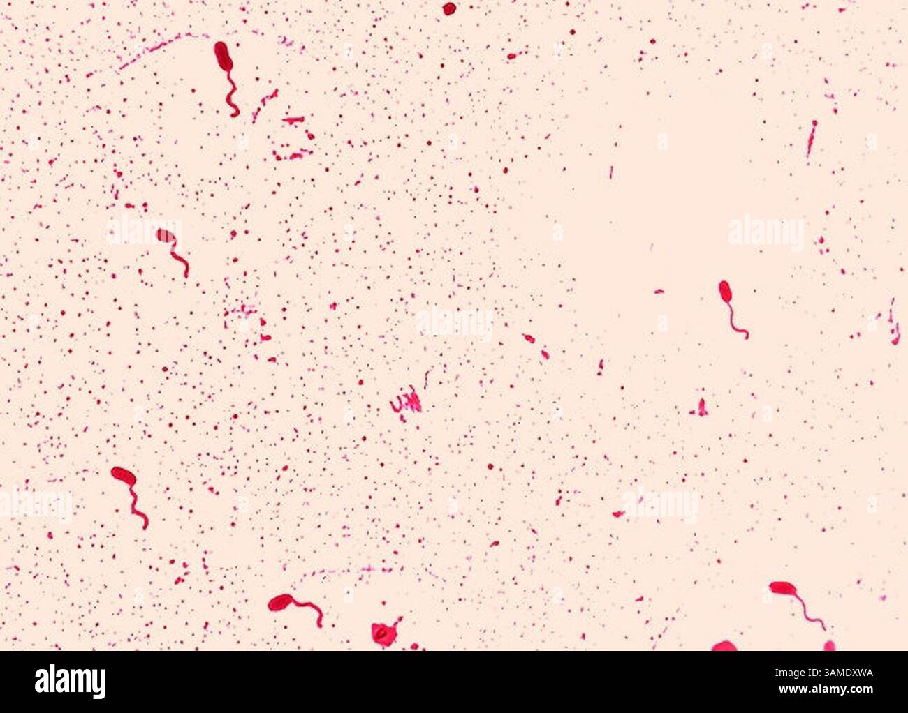 14 settembre 2000 - FRANCOBOLLO, Stati Uniti - KRT US NEWS STORY SLUGGED: GERMS KRT FOTOGRAFIA GENTILMENTE CONCESSA DAL CENTRO PER IL CONTROLLO DELLE MALATTIE (18 settembre) questa è un'immagine microscopio elettronico di gruppo di batteri Vibrio cholerae, un microbo "quorum-sensing" che può inviare e ricevere segnali chimici da altri come esso, in effetti conducendo un conteggio della testa dei suoi vicini. I piccoli insetti sono geneticamente programmati per aspettare che ne siano stati assemblati abbastanza prima di lanciare un attacco di colera mortale. (KRT) PL BL KD 2000 (HORIZ.) (kn) (immagine di credito: © Center for Disease Control/mct/ZUMAPRESS.com) Foto Stock