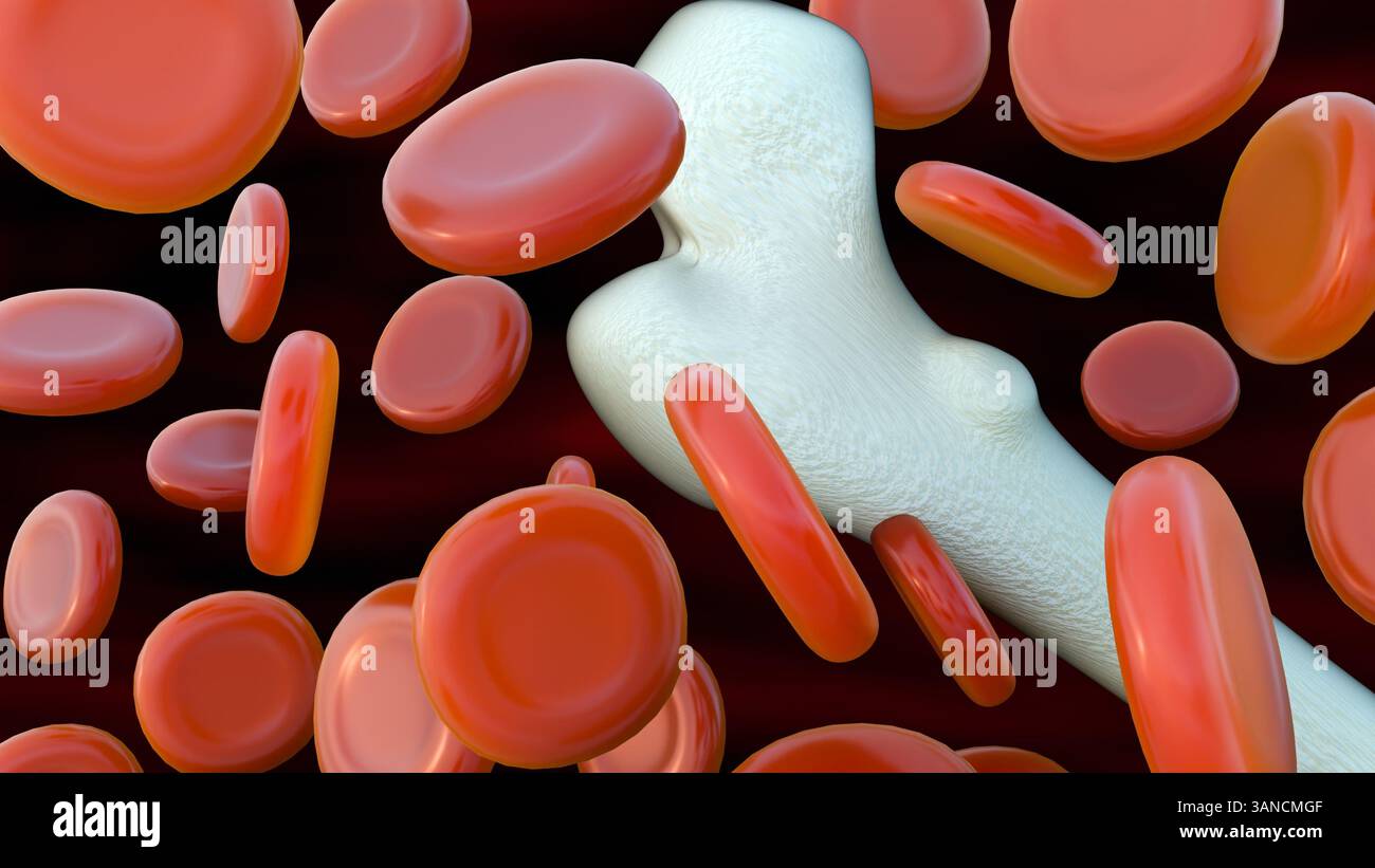 Una rappresentazione 3d di eritrociti o eritrociti sparsi è rappresentata in modo prominente accanto a un osso femorale. Foto Stock