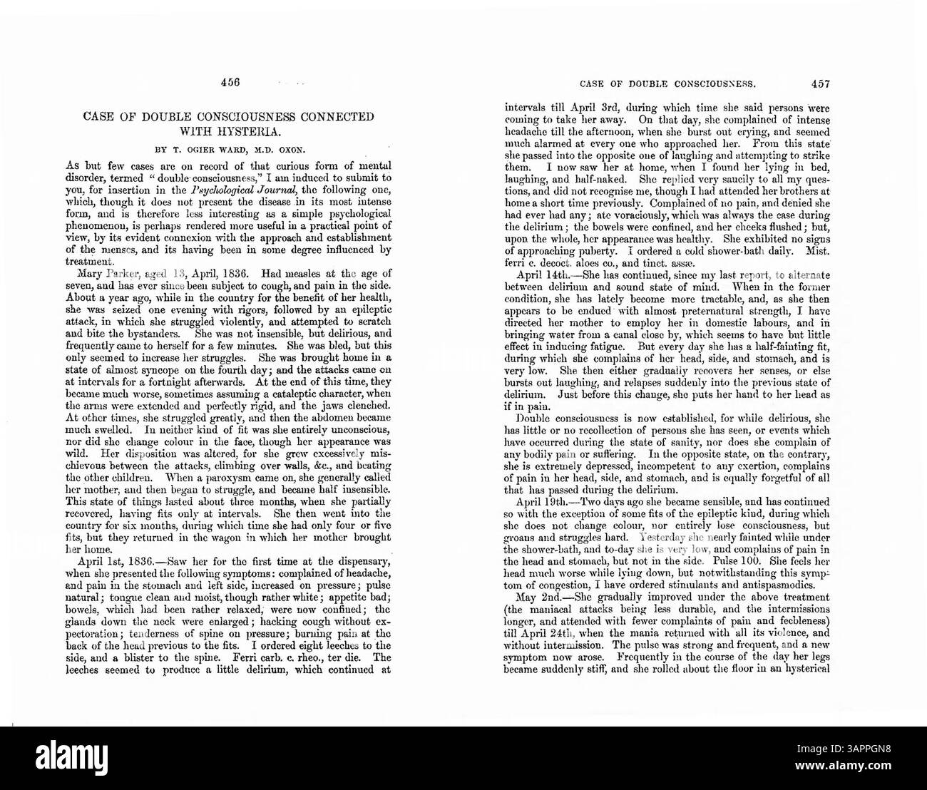 Il caso di studio del dottor Ward sulla tredicenne Mary Parker, che ha subito attacchi epilettici, mal di testa e delirio dopo aver sofferto di morbillo. I suoi sintomi erano legati sia all'epilessia che all'isteria, risolvendo in ultima analisi con l'insorgenza delle mestruazioni. Foto Stock