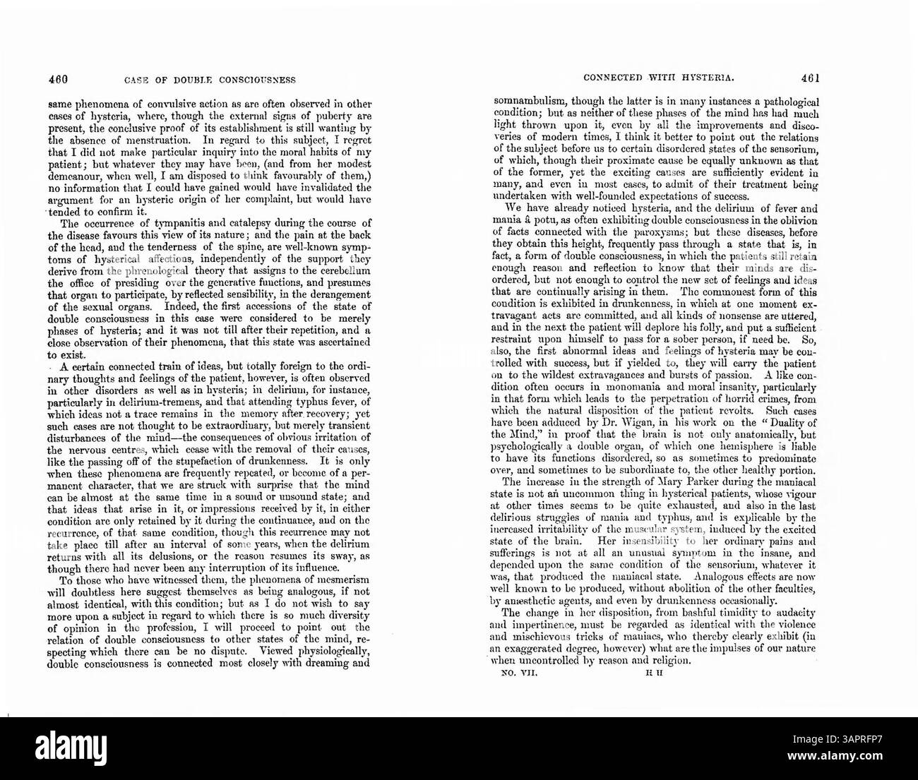 Il dottor Ward presenta il caso di Mary Parker, una ragazza di 13 anni che ha subito attacchi epilettici a partire dai 12 anni, a seguito di un'infezione da morbillo all'età di 7 anni. Nonostante vari trattamenti, tra cui le sanguisughe, i suoi sintomi, tra cui mal di testa e confusione mentale, si risolsero quando raggiunse il menarca, suggerendo che la condizione era sia epilettica che isterica di origine. Foto Stock
