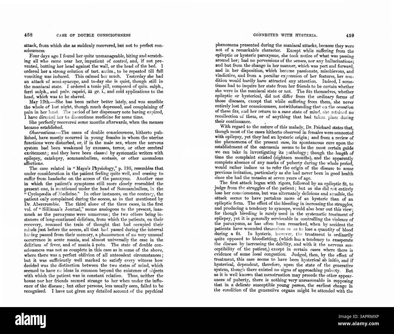Il dottor Ward documenta il caso di Mary Parker, una ragazza di 13 anni i cui sintomi includevano epilessia, mal di testa e delirio a seguito di un'infezione da morbillo. Il caso evidenzia una diagnosi di isteria legata all'epilessia, che si è risolta durante la pubertà. Foto Stock