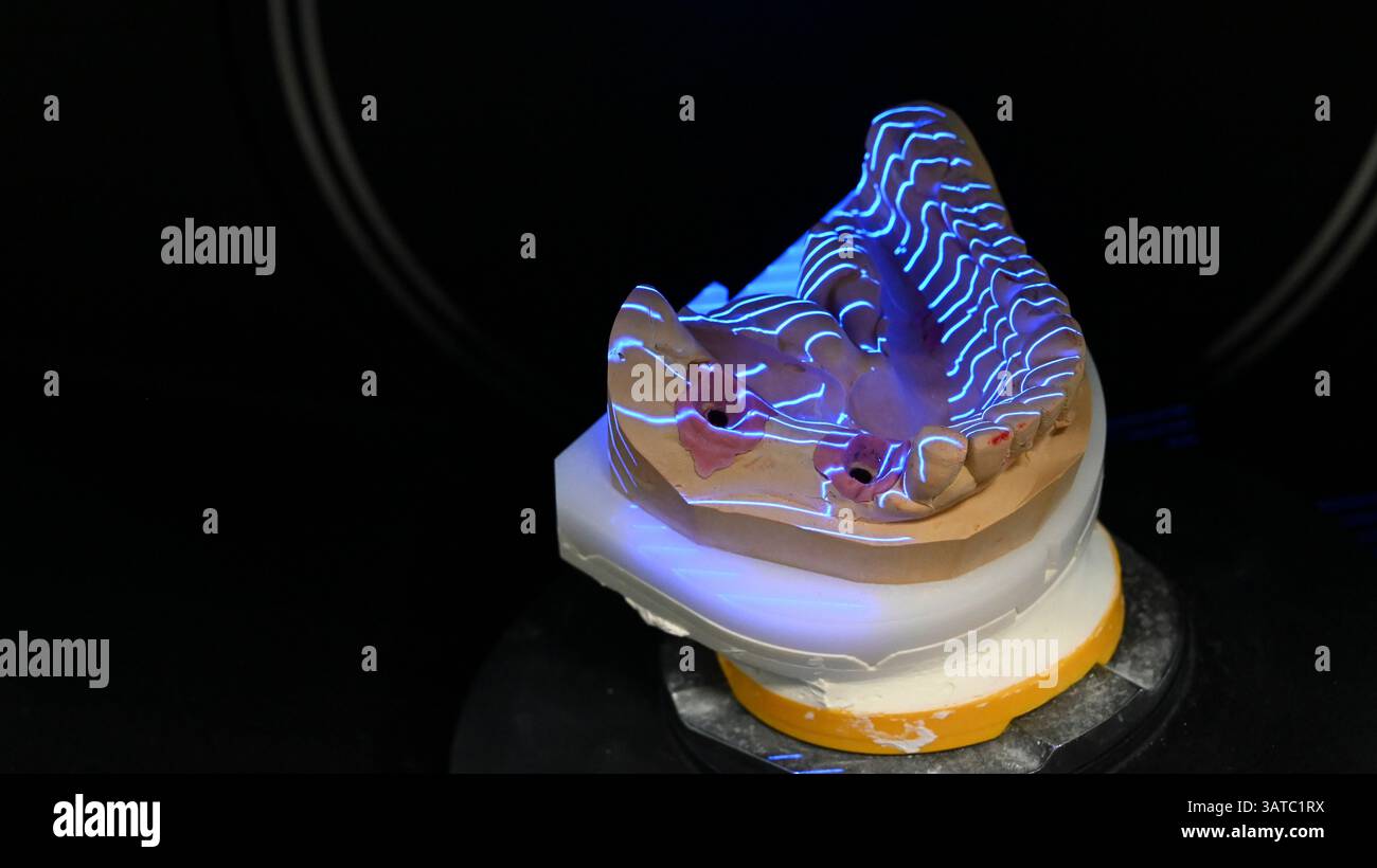 Gli scanner 3D con tecnologia digitale dentale eseguono la scansione di un modello di impronta da mordere per l'elaborazione da parte del tecnico dentale, la moderna tecnologia dentale. Foto Stock