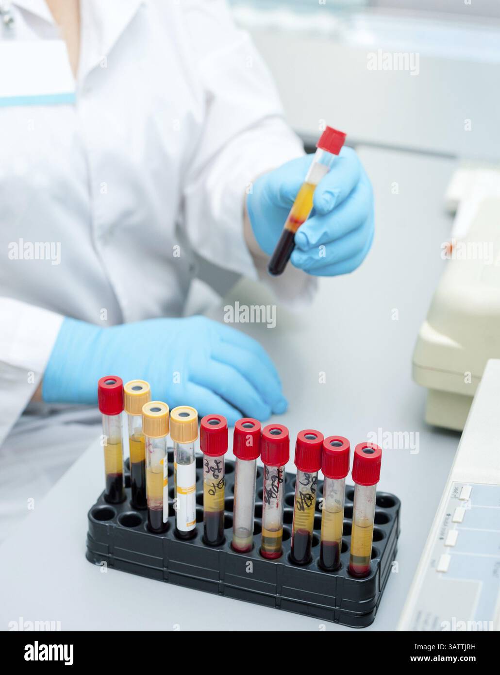 Un infermiere dispone le provette di analisi con il sangue su un vassoio Foto Stock