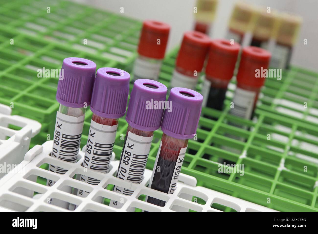 Donazione di sangue Foto Stock