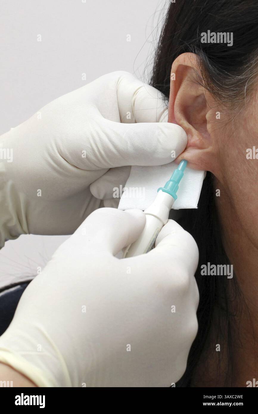 Test dell'emoglobina Foto Stock