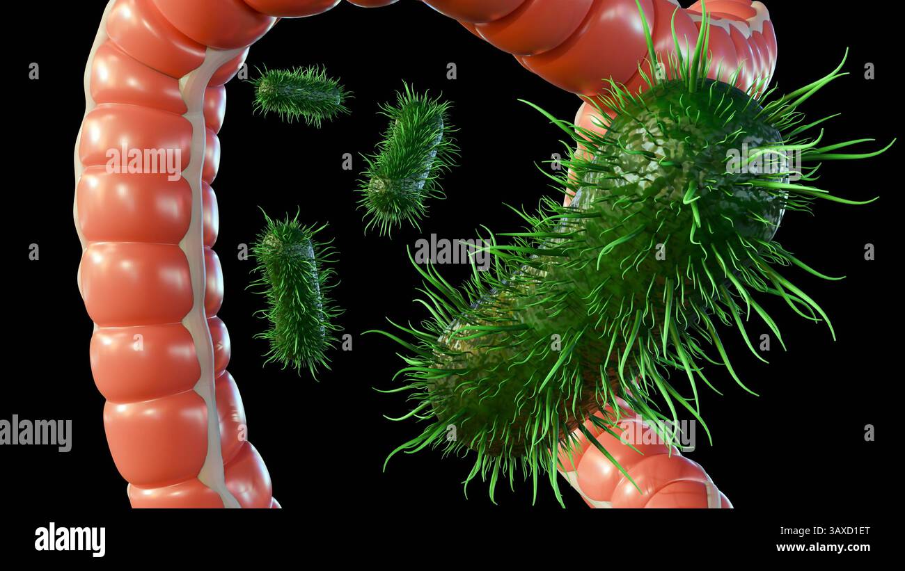 Rendering 3d del colon umano o dell'intestino crasso e dei batteri patogeni. Foto Stock