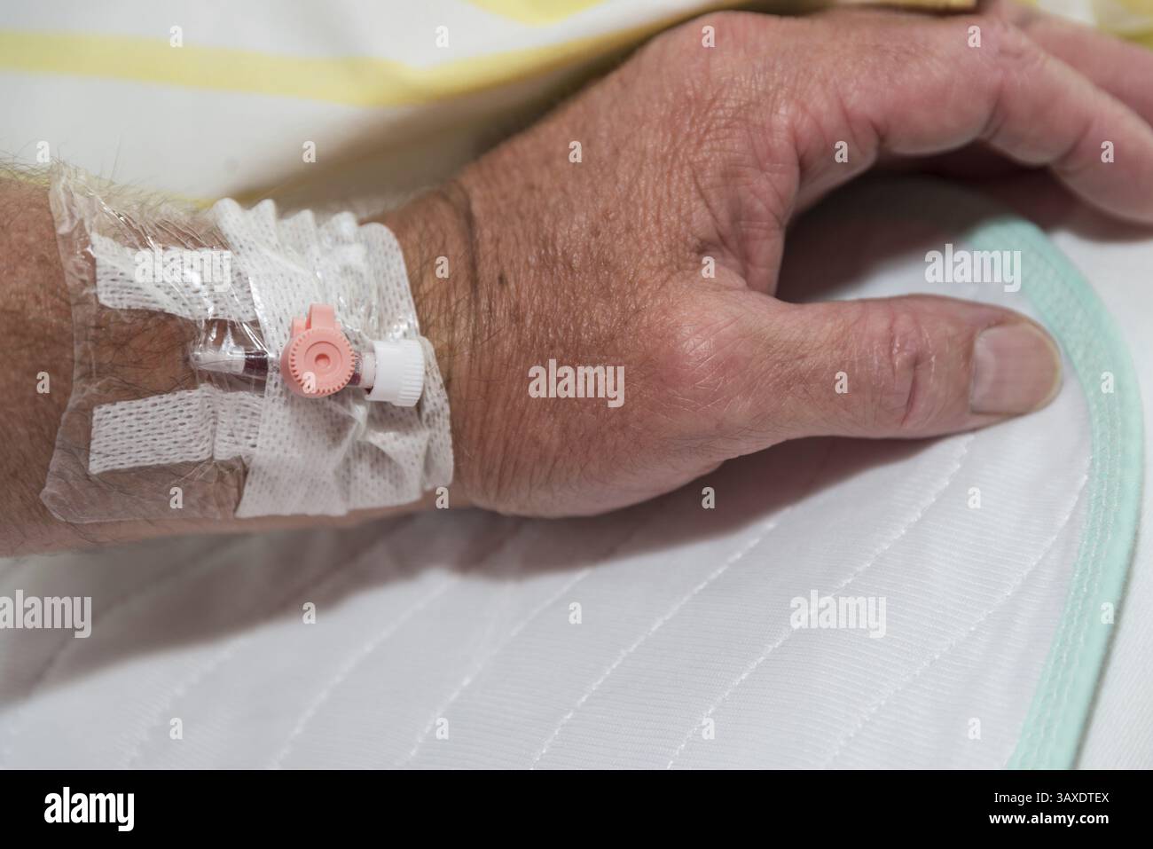Cannula per il prelievo di sangue e l'iniezione - catetere venoso, primo piano Foto Stock