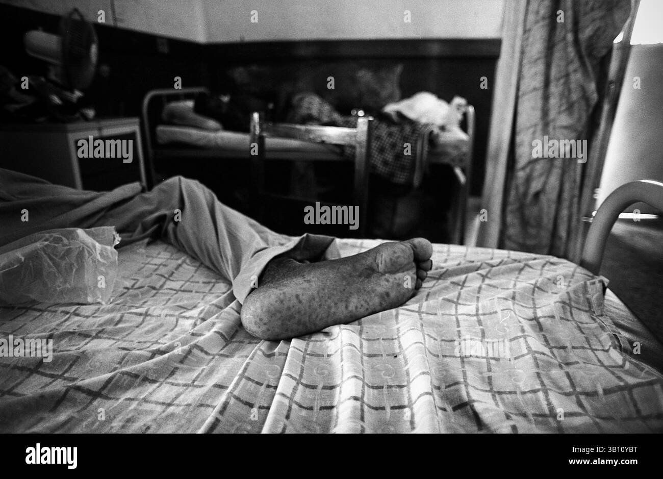 14 settembre 2010 - Freetown, Sierra Leone - Connaught Hospital è il più grande ospedale di Freetown. Il governo della Sierra Leone ha recentemente introdotto una nuova iniziativa sanitaria che consente l'assistenza sanitaria universale gratuita ai bambini di età inferiore ai 5 anni e alle donne incinte. Queste foto mostrano un raro assaggio dell'assistenza sanitaria in un paese devastato da più di un decennio di guerra. Mentre il sistema sanitario ha avuto un impulso per i più vulnerabili, ha ancora molta strada da fare. NELLA FIGURA è illustrato il piede di un paziente su uno dei reparti maschili. (Immagine di credito: © Noah Goodrich/ZUMApress.com) Foto Stock