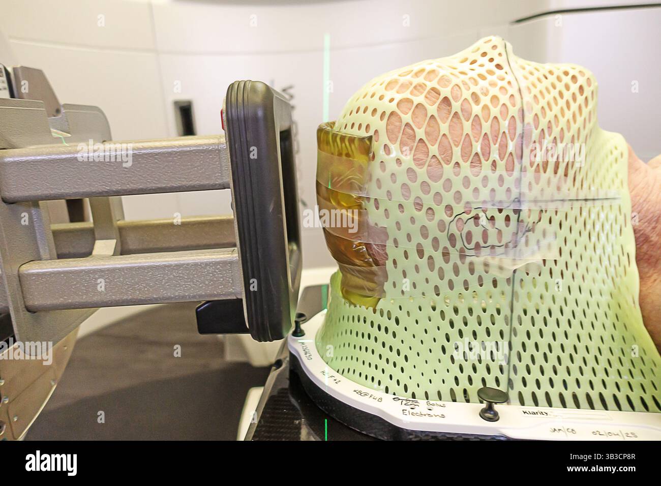 Maschera facciale sul paziente oncologico pronto per il trattamento su una macchina di radioterapia TrueBeam. Foto Stock