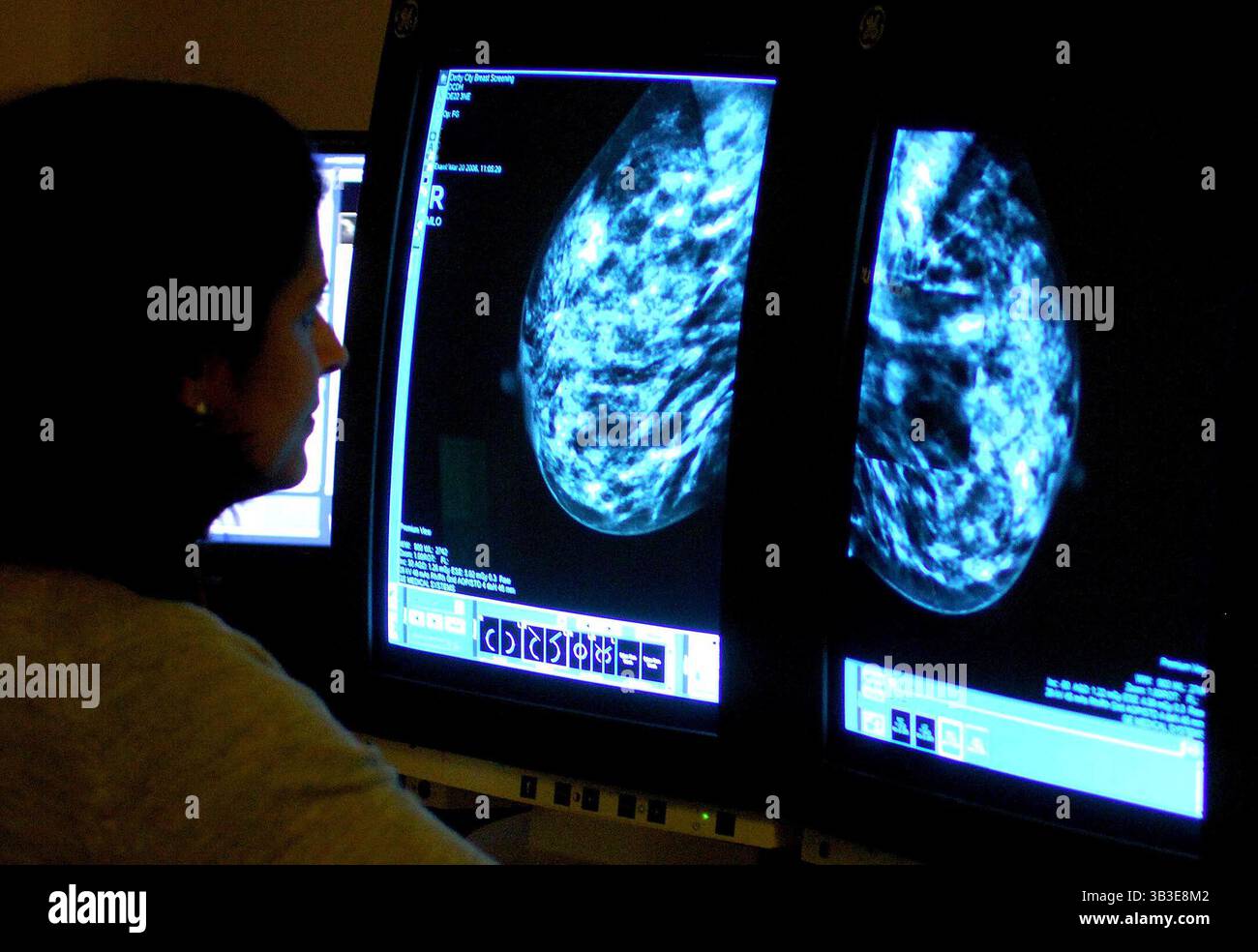 Foto del file datata 15/06/06 di un consulente che analizza una mammografia del seno di una donna per controllare il cancro al seno. Kemi Badenoch ha detto che non vorrebbe un uomo che esegua un esame "intimo" che controlli il cancro al seno. Data di pubblicazione: Martedì 29 aprile 2025. Foto Stock