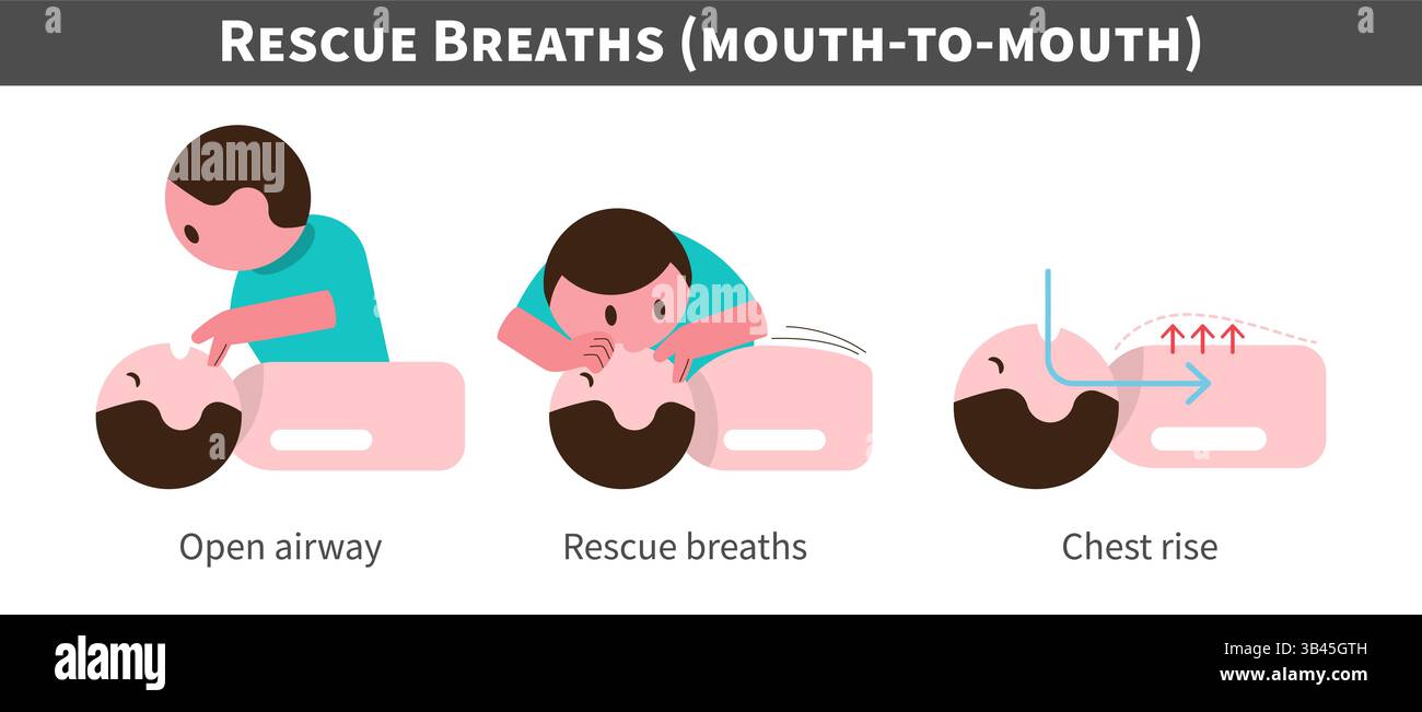 CPR . Rianimazione cardiopolmonare . Procedura di respirazione di salvataggio e bocca e bocca. Personaggi dei cartoni animati dal design piatto . Isolare lo sfondo bianco . VEC Illustrazione Vettoriale CPR . Rianimazione cardiopolmonare . Procedura di respirazione di salvataggio e bocca e bocca. Personaggi dei cartoni animati dal design piatto . Isolare lo sfondo bianco . VEC Illustrazione Vettoriale