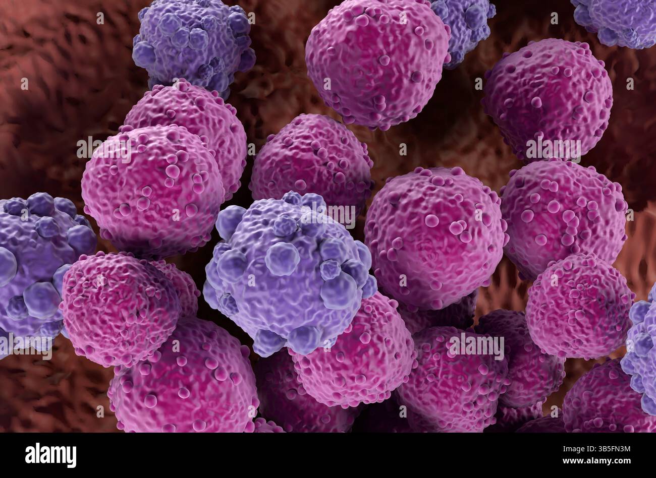 Linfoma cellulare - Vista isometrica illustrazione 3d. Foto Stock