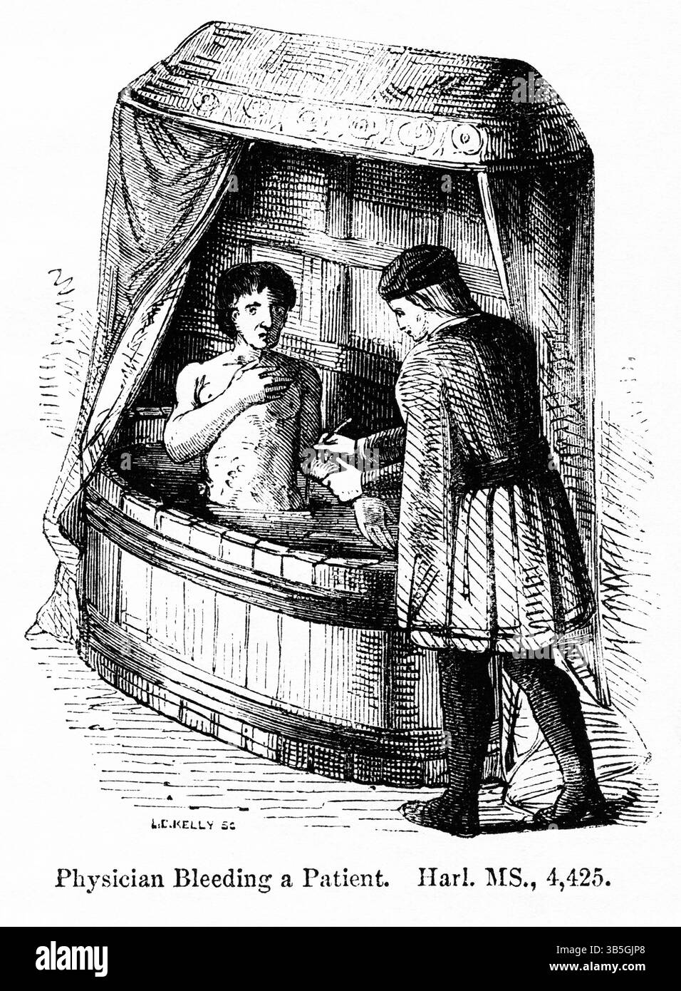 2 maggio 2022, Londra, Inghilterra, Regno Unito: Physician Bleeding a Patient, Illustration from the Book, ''John Casselâ€™s Illustrated History of England, volume II'', testo di William Howitt, Cassell, Petter e Galpin, Londra, 1858 (immagine di credito: © JT Vintage/Glasshouse tramite ZUMA Press Wire) Foto Stock