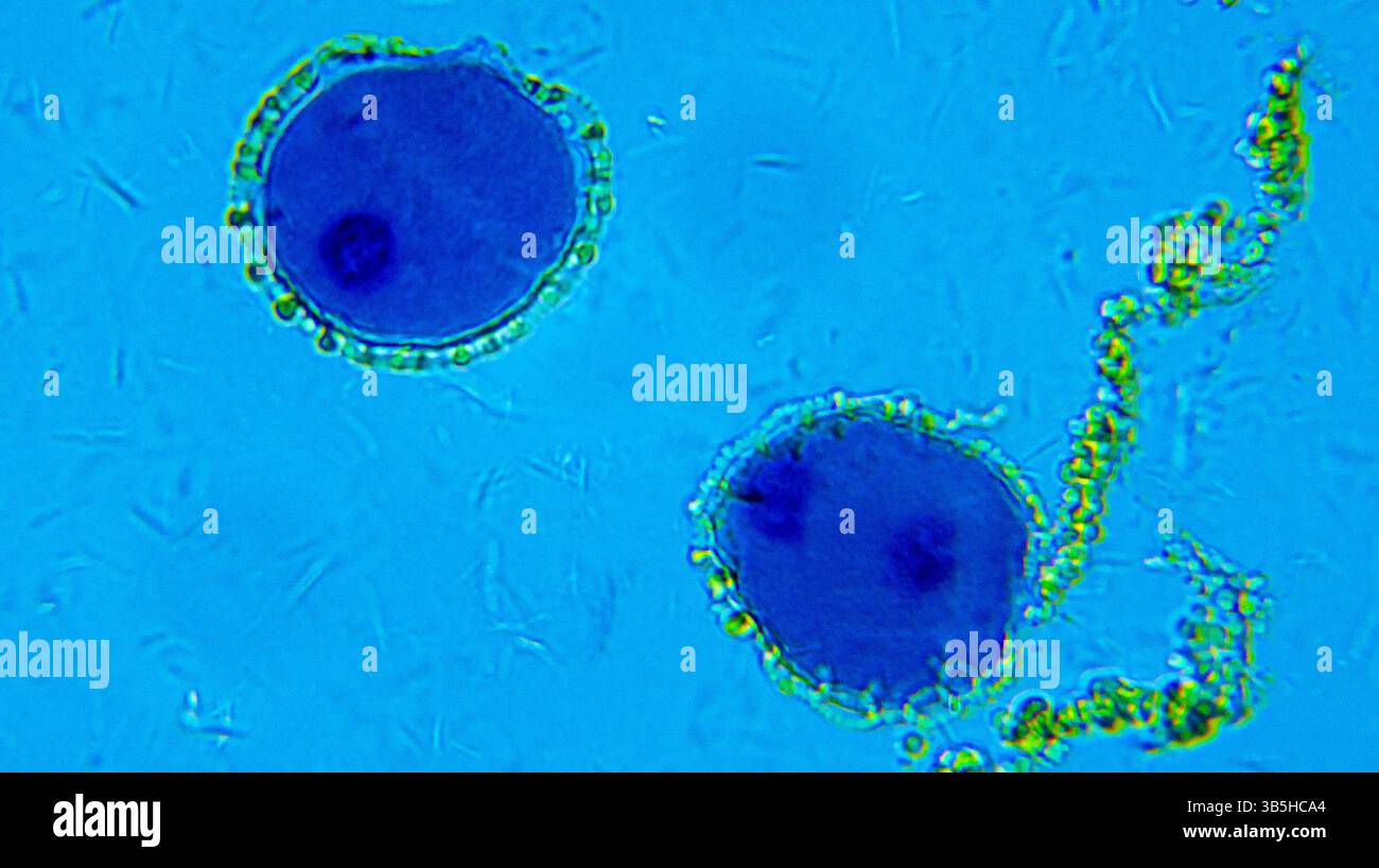 Lillium anther sotto microscopio ottico Foto Stock