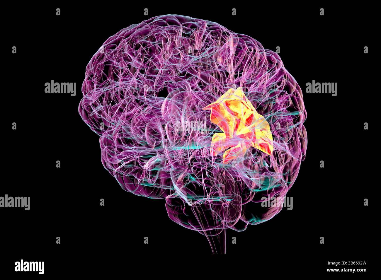 Cervello umano con il circolo precuneo evidenziato, mostrando il suo ruolo nella riflessione di sé, nella memoria, nella consapevolezza spaziale, e il suo coinvolgimento in varie condizioni neuropsichiatriche, nell'illustrazione al computer. Foto Stock
