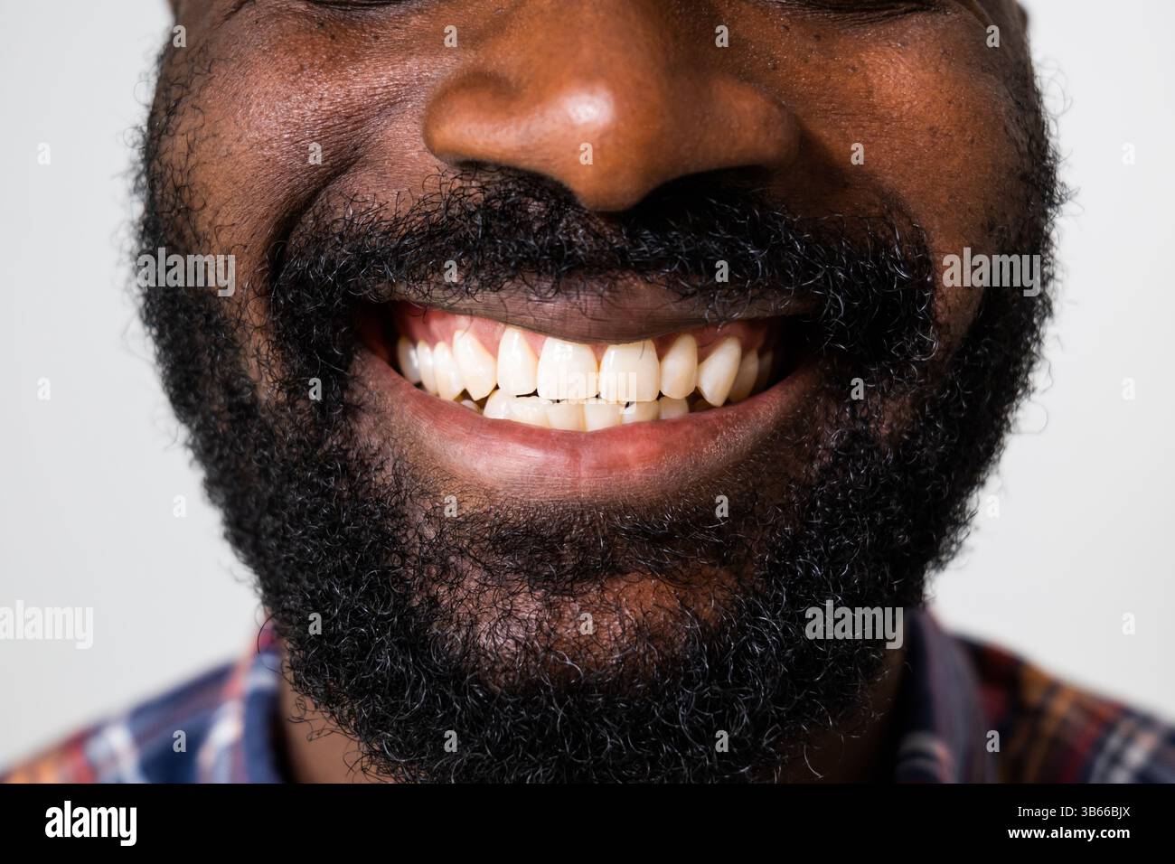 Primo piano ritratto dei denti di un uomo nero adulto sorridente. Foto Stock